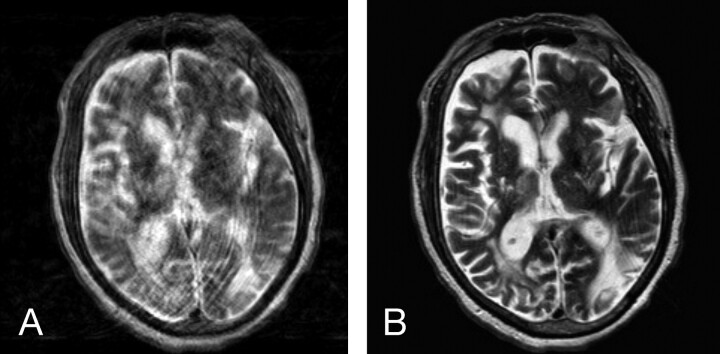 Fig 3.