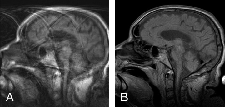 Fig 2.