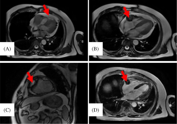 FIGURE 1