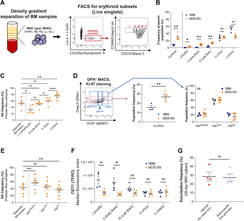 Figure 1. Erythroid differentiation and enucleation remain active in SF3B1mt MDS-RS erythroblasts. A, Flow cytometry strategy for staging of erythroblast populations from BM MNC of patients with MDS-RS. Gating steps identify live and terminally differentiating erythroid cells (Lin−7AAD−GPA+), from which erythroblasts (EB) are staged according to Band 3 and integrin α4 expression (26). Integrin α4–negative cells are excluded from quantification to avoid skewing by anucleate cells. B, Mean (±SEM) cell population frequencies within flow cytometry parent populations (singlets > terminally differentiating erythroid > erythroblast subsets), quantified in NBM donors (nNBM = 4) and patients with MDS-RS (nMDS-RS = 6). Erythroid cells are quantified within the singlet population. Erythroblast subsets are quantified within the GPA+ population. C, Mean (±SEM) RS frequencies per sorted erythroblast subset and compared with frequencies in matched diagnostic BM smears (nMDS-RS = 6). D, Gating and quantification [mean (±SEM)] of DNA content (Draq-5) and intracellular Ki-67 abundance in GPA+ magnetically sorted cells (nNBM = 3; nMDS-RS = 6). E, Mean (±SEM) RS frequencies per sorted Ki67-expressing subset and compared with frequencies in matched diagnostic BM smears (nMDS-RS = 6). F, Mean (±SEM) CD71 (transferrin receptor, TFRC) median fluorescence indices per erythroblast subset (nNBM = 4; nMDS-RS = 6). G, Mean (±SEM) enucleation frequencies after 28-day 3D culture of MDS-RS BM MNCs (nMDS-RS = 4) and separated by iron granule visibility upon morphological analysis. Statistical comparison was performed by paired t test analysis. *, P < 0.05; **, P < 0.01; ***, P < 0.001; ns, nonstatistically significant.