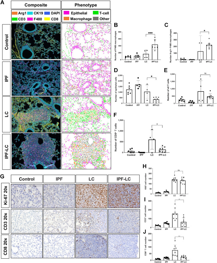 Figure 2. Tumor progression of pulmonary lesions is associated with increased macrophage infiltration and decrease of cytotoxic T cells. A, mIF performed on lung section from at least 3 mice per group. Representative composite images of immunofluorescence (left) are shown at 4x magnification and antibody stains are shown in corresponding colors: Arg1 (orange), CK19 (light blue), DAPI (dark blue), CD3+ (green), F4/80 (pink), CD8+ (yellow). Representative images of computational phenotype are depicted on the right with cell phenotypes in corresponding colors as indicated: macrophages (orange), T cells (green), epithelial (pink), other (grey). B–F, Quantification of F4/80+ macrophages, Arg1+ F4/80 macrophages, and CK19 epithelial, all T cells (CD3) and CD8+ T cells abundance of quantified composite images. Data is represented ± SEM and statistical significance determined by one-way ANOVA with post hoc Fisher least significant difference (LSD) test and denoted as: *, P < 0.05; ***, P < 0.005; or ns, no statistical difference. G, Representative images (20x) of lung section in each group at endpoint stained with Ki-67, CD3+, and CD8+. H–J, Quantification of Ki67, CD3+ T cells and CD8+ T cells counted on lung section stained with corresponding antibody. Data represented ± SEM and statistical significance determined with one-way ANOVA with post hoc Tukey HSD test and significance of: **, P < 0.01; ***, P < 0.001; or ns, not statistically different.