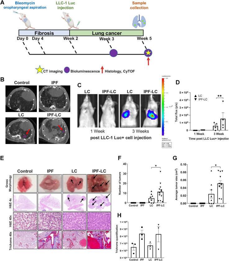 Figure 1. Modeling pathogenesis of IPF-LC in a murine model. A, Schematic indicating experimental outline: C57BL/6-albino mice were randomized into four experimental cohorts for all comparative studies: control, IPF, LC, and IPF-LC. Mice in the control group received appropriate vehicles (control), mice in the IPF group received 0.5 mg/kg and 1 mg/kg of bleomycin on day 0 and day 4, respectively, by OA. Mice in the LC group received LLC-1 Luc cells (1 × 106 cells/100 μL) by intravenous injection into the tail vein (intravenously) on day 14 and mice in the IPF-LC group received 0.5 mg/kg and 1 mg/kg of bleomycin (OA) on day 0 and day 4, respectively, and LLC-1 Luc cells (intravenously) on day 14. Timepoints for micro-CT and BLI or tissue collection are denoted by a yellow star, a purple circle, and a red arrow respectively. B, Representative micro-CT images from all groups at study endpoint. Tumor lesions in LC group and IPF-LC group are indicated by red arrows and circled in pink. C, Representative BLI images from mice in LC and IPF-LC groups at week 1 and 3 (day 21 and day 28) post LLC-1 Luc injection. D, Quantification of bioluminescence at indicated timepoints of mice in the LC (n = 4) and IPF-LC (n = 4) groups. Data is presented ± SEM and statistics were performed using one-way ANOVA with post hoc Tukey (Honestly Significant Difference (HSD)) test with statistical significance denoted as: **, P ≤ 0.01. E, Representative images of gross morphology, H&E and trichome staining of lung images and lung sections acquired at study endpoint at 5 weeks post first bleomycin injection. Black arrows indicate tumors on H&E-stained lung sections of mice in LC and IPF-LC groups. F, Quantification of the number of tumors in the LC and IPF-LC groups counted on 1x H&E-stained lung sections presented ± SEM. Statistical test was performed with one-way ANOVA with post hoc Tukey HSD test and significance indicated as: *, P ≤ 0.05. G, Quantification of the average tumor size in the lung in LC and IPF-LC groups measured on 1x H&E-stained lung sections. Data is represented ±SEM and statistical significance determined using one-way ANOVA with post hoc Tukey HSD test and significance of *, P ≤ 0.05. H, Quantification of collagen in trichrome staining of lung sections. No statistical difference was determined between groups.