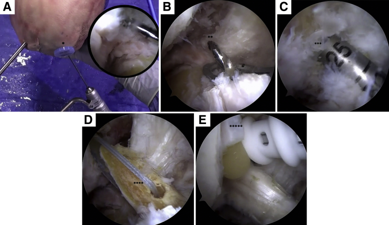 Fig 6