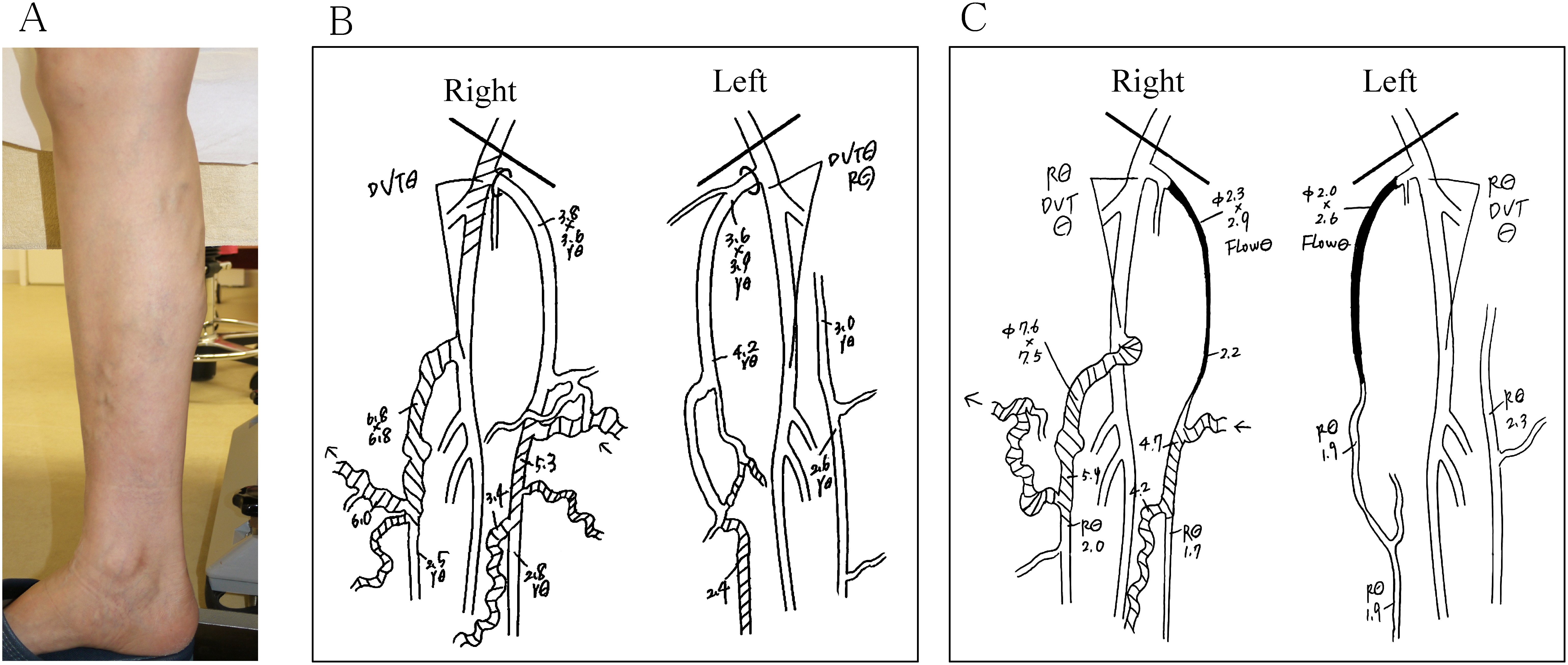 Fig. 2 A case of improper treatment.