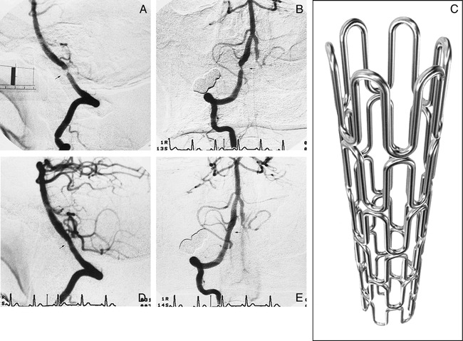 fig 1.