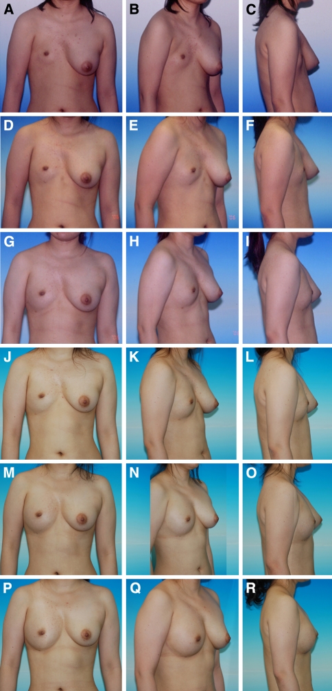 Fig. 1