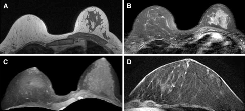 Fig. 4