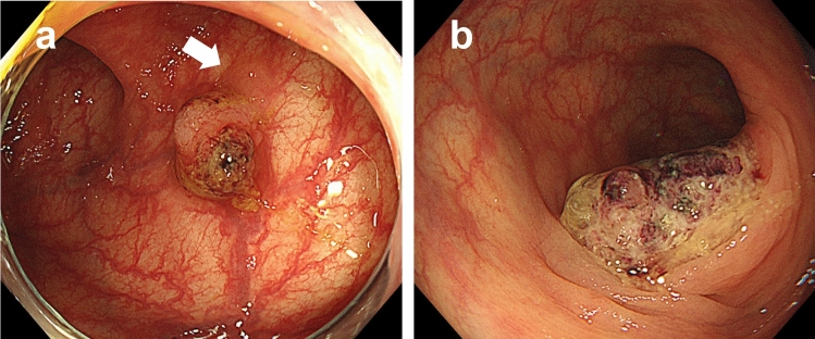 Fig. 1