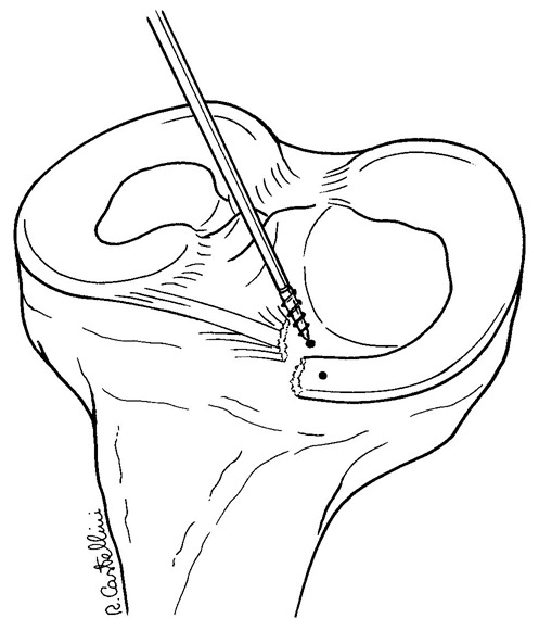 Figure 3–4