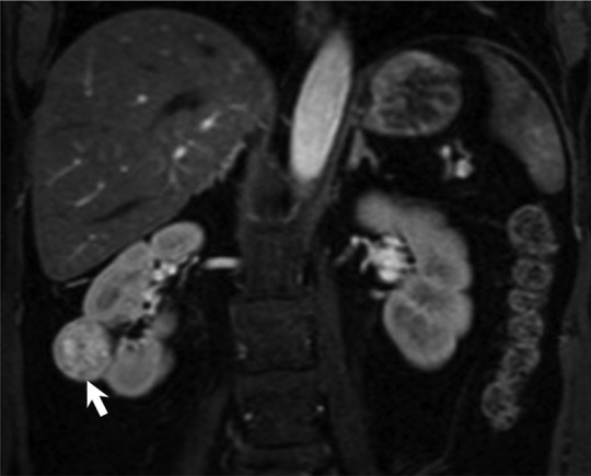 Figure 3b: