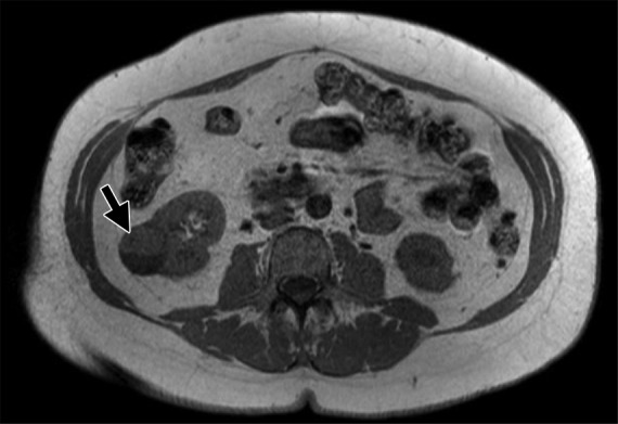 Figure 3c: