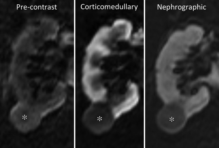 Figure 4b: