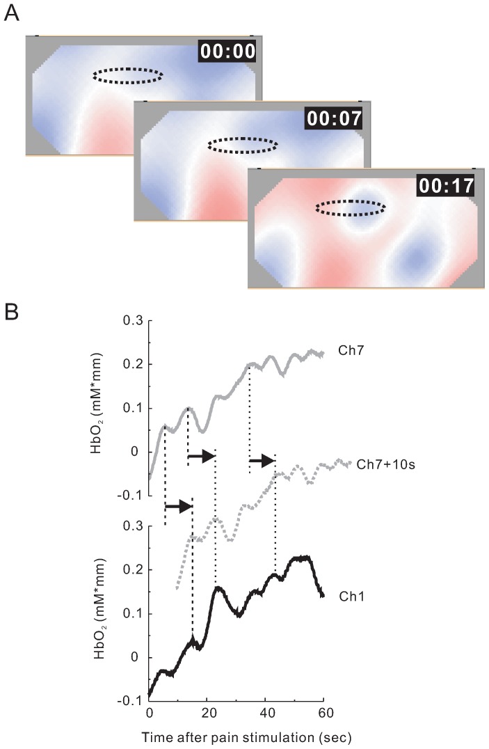 Figure 6