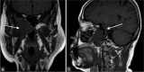 Figure 5: