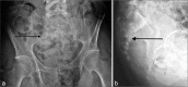 Figure 11: