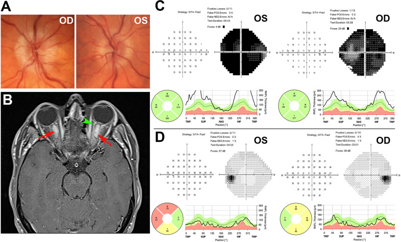 Fig. 3