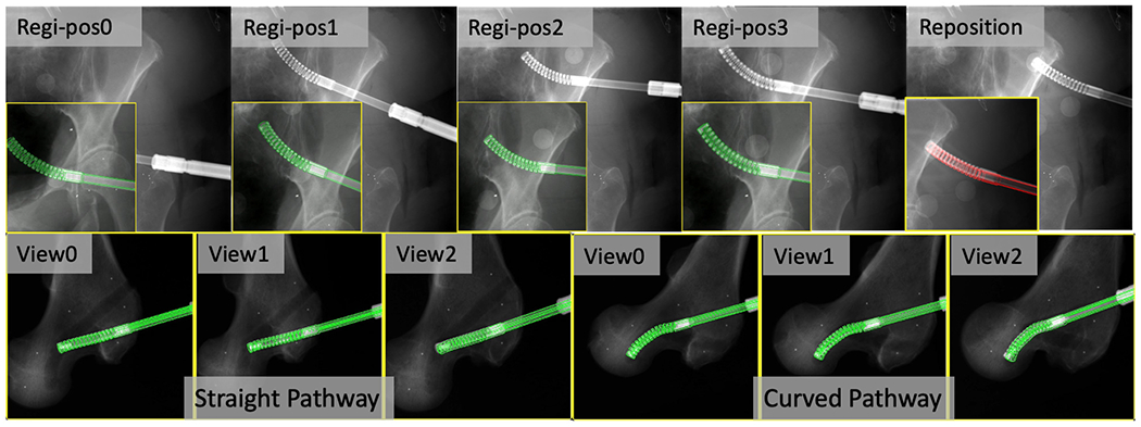 Fig. 12.