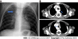 Figure 21