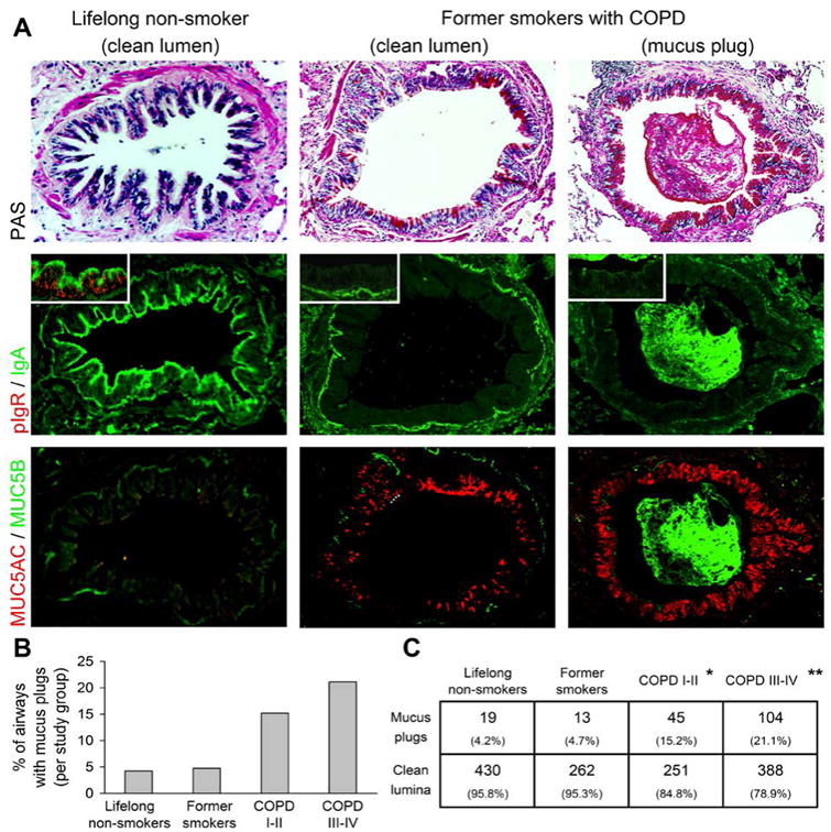 Secretory Iga From Submucosal Glands Does Not Compensate For Its Airway 