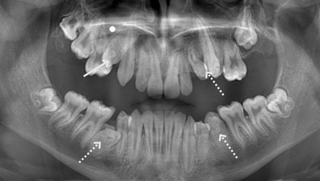 Fig. 3