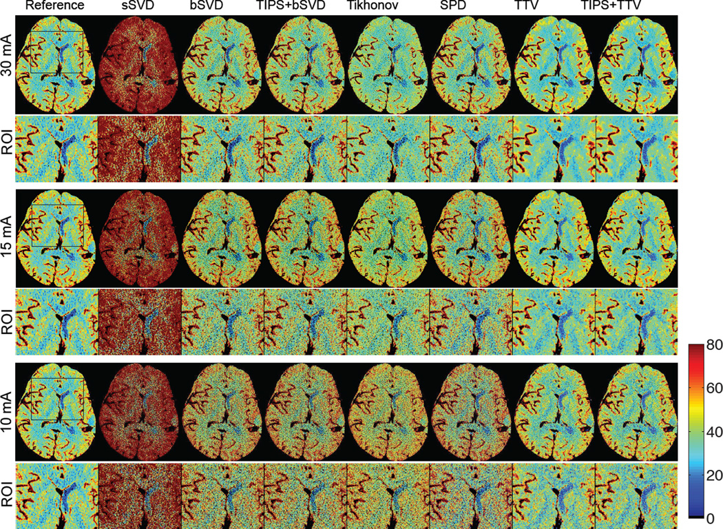 Fig. 11