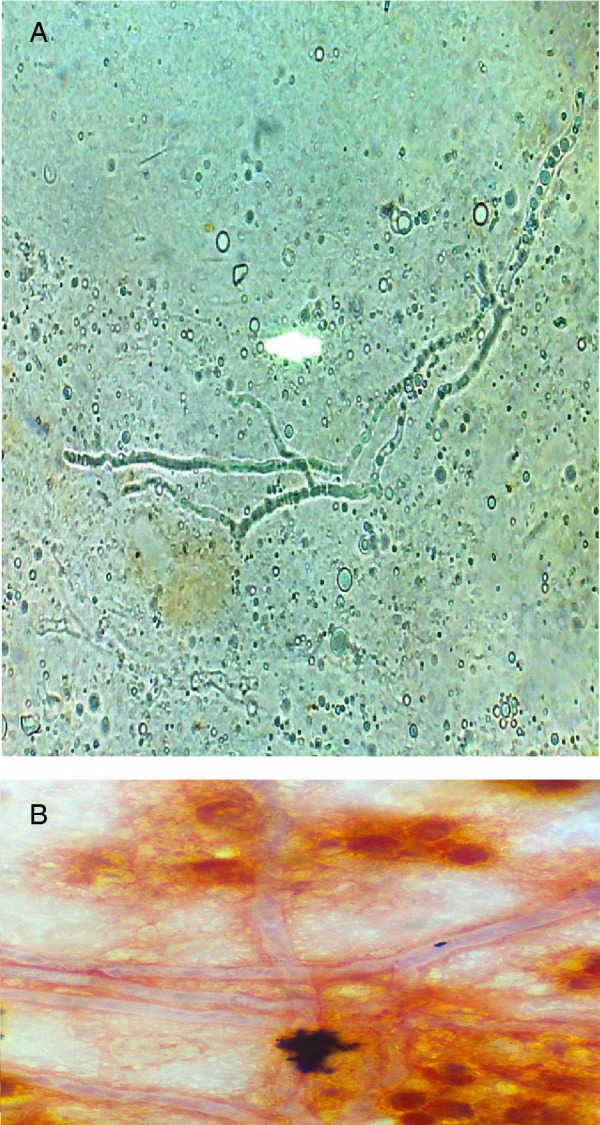 Figure 4