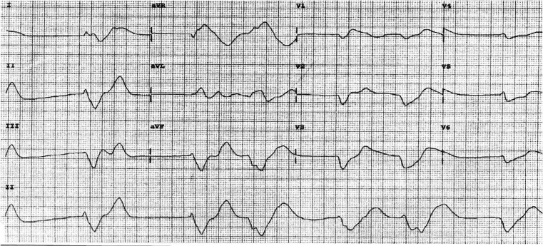 Fig. 1