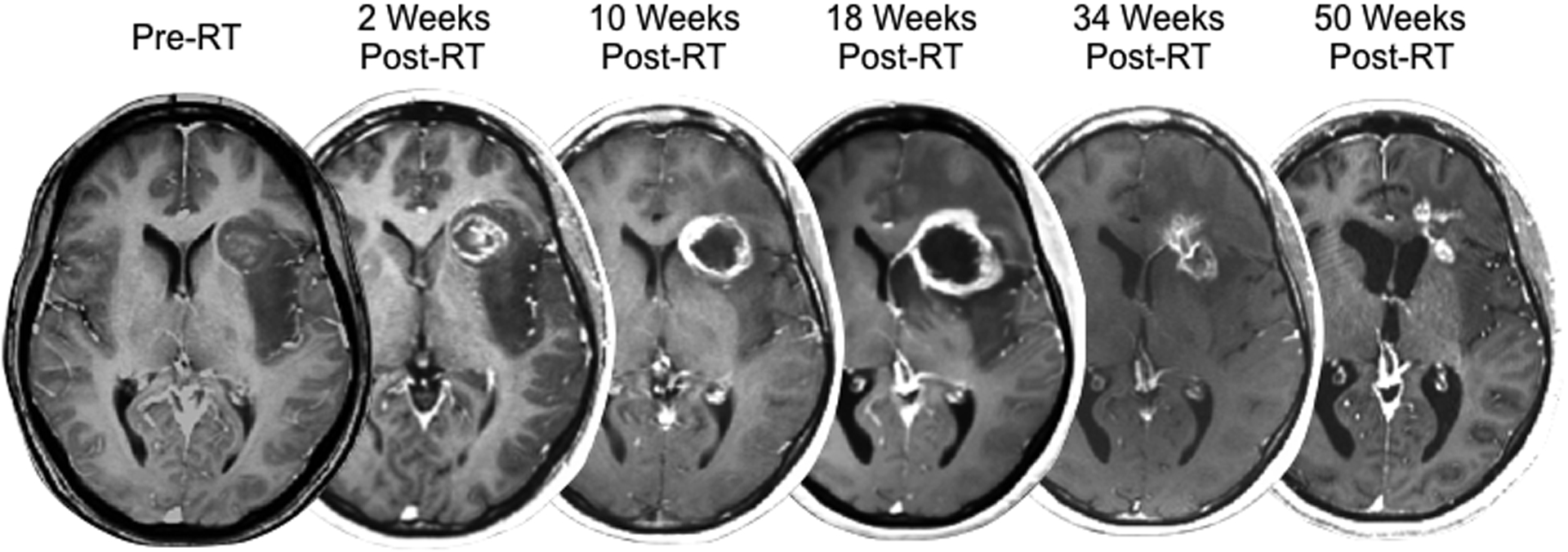 Fig 1.