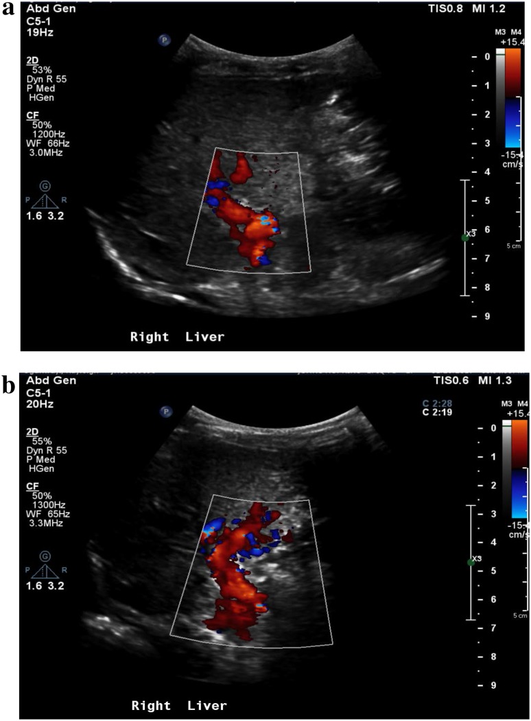 Fig. 3