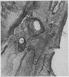 199