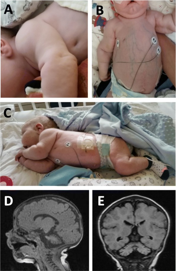 Fig. 1