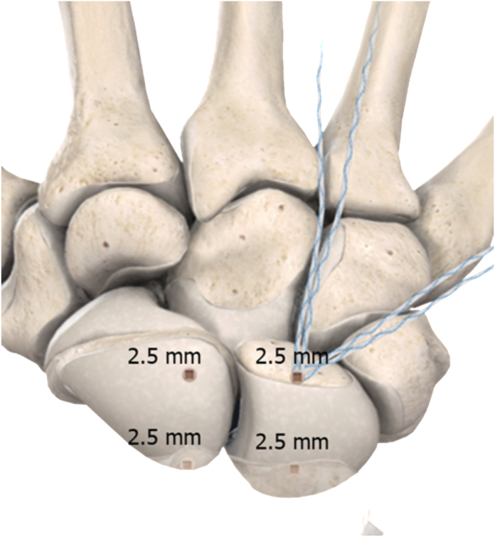 Figure 3