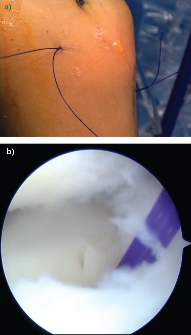 Fig. 9