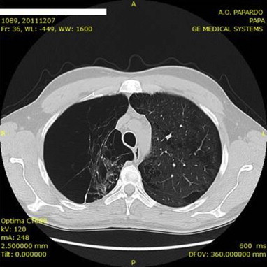 Fig. 1