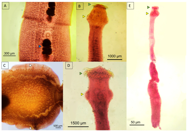 Figure 11