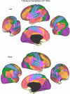 Fig. 11.