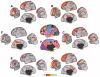 Fig. 34.