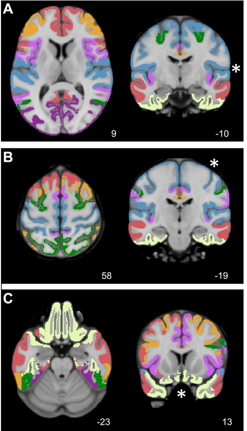 Fig. 14.