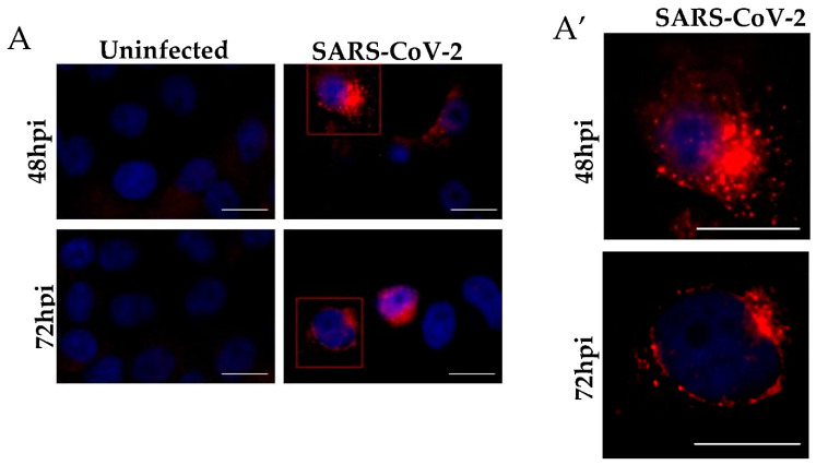 Figure 12