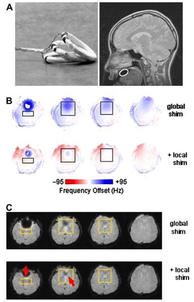 Fig. 17