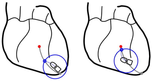 Fig. 11