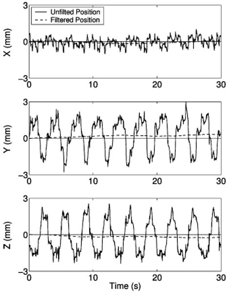 Fig. 16