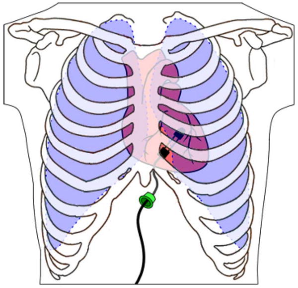 Fig. 1