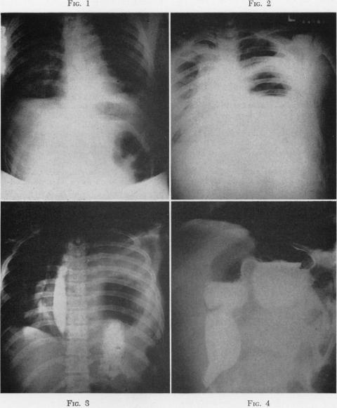 Fig. 1., Fig. 2., Fig. 3., Fig. 4.