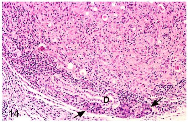 Figure 14