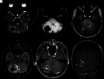 FIG 2.