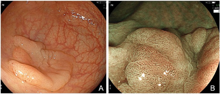 Figure 5.