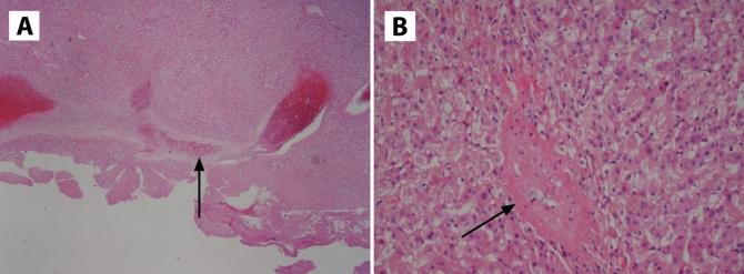 Figure 2)