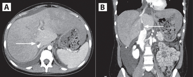 Figure 1)