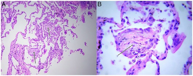 Figure 3